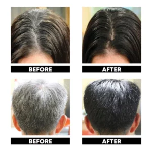 ATTDX AntiVergrau Zurückgewinnen Haare Serum