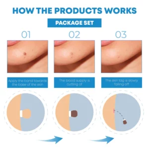 ATTDX AutoSkinTag PainlessRemoval Device Kit