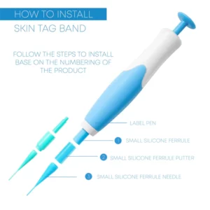 ATTDX AutoSkinTag PainlessRemoval Device Kit