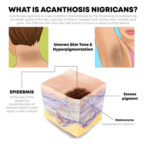 ATTDX Bambù Acanthosis Nigricans WhiteningSoap