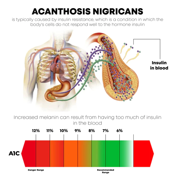 ATTDX ХулсанНүүрс Acanthosis Nigricans WhiteningSoap