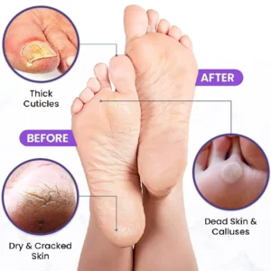 ATTDX FootCorn Calluses Lavender PeelMask