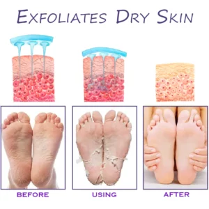 ATTDX FootCorn Calluses Lavender PeelMask