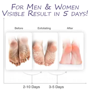 ATTDX FootCorn Calluses Lavender PeelMask