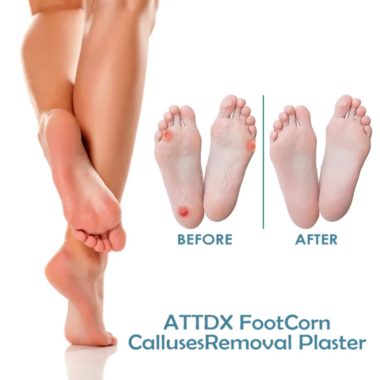ATTDX FootCorn Calluses Removal Plaster