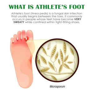 Alternative view of ATTDX FreshFeet Debacteria Botanical Spray