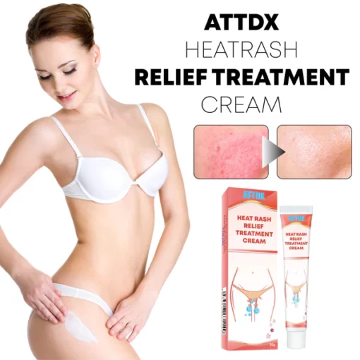 ATTDX HeatRash Relief TreatmentCream