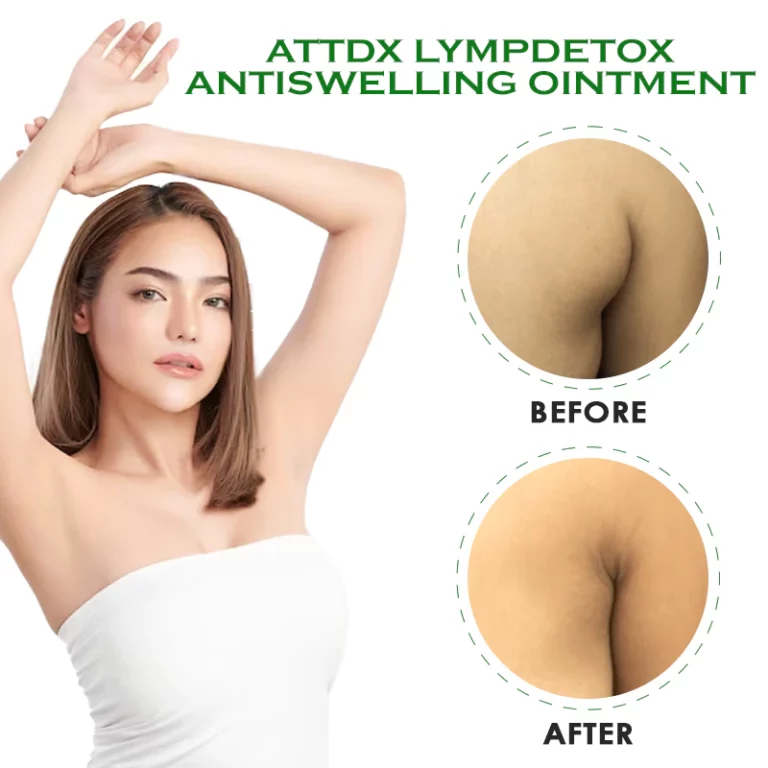 ATTDX LympDetox AntiSwelling Salve