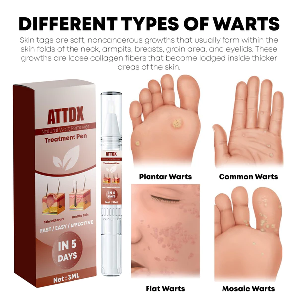 ATTDX Natural WartRemover penna per il trattamento