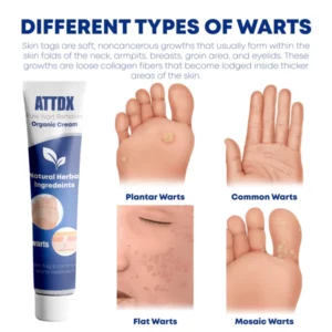 ATTDX PURE WartRemover Organic Cream