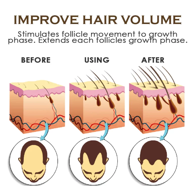 Spray për trajtimin e rritjes së flokëve ATTDX PureGinger
