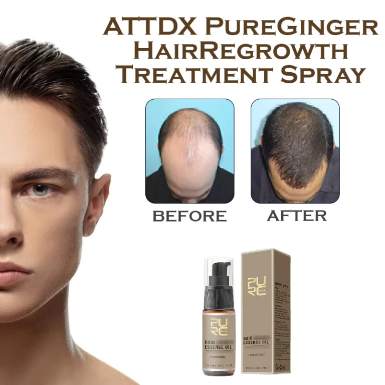 ATTDX PureGinger HairRegrowth gydomasis purškiklis