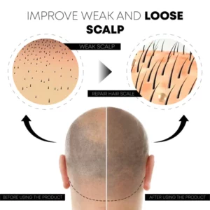 ATTDX ScalpFolliculitis Relief TherapyOil