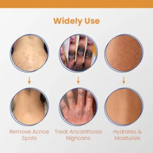 AcneXpert+™ Blemish Skin Clarifying Cleansing Lotion