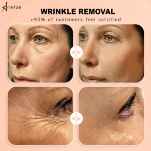 Anti-wrinkle Skin Rebounce Moisturizing Balm
