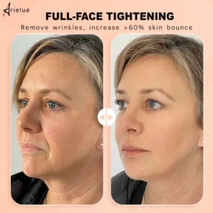 Anti-wrinkle Skin Rebounce Moisturizing Balm