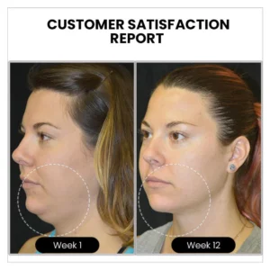 Atheniz MagneTech Acupuncture Earrings