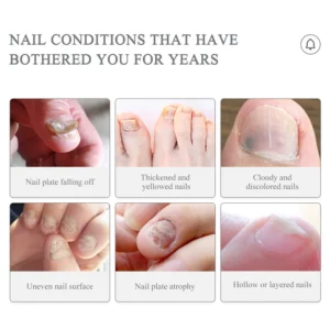 BREYLEE™ Nail Treatment Serum Pen