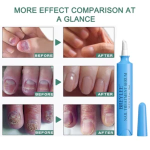 BREYLEE™ Nail Treatment Serum Pen