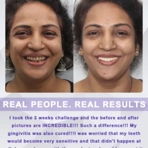 BeamingBite™ Whitening Mouthwash