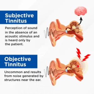 Biancat™ AuriCalm Tinnitus Relief Device