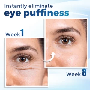 Biancat™ LumièreLift Peptide Eye Serum