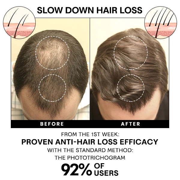 Blusoms™ Anti-Haarausfall-Haarspray