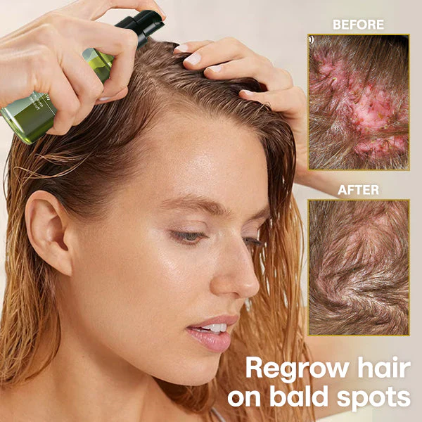 Blusoms™ Olive Hair Scalp Repair Spray