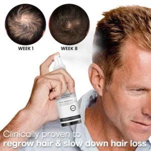 Blusoms™ Anti-Shedding Hair Spray