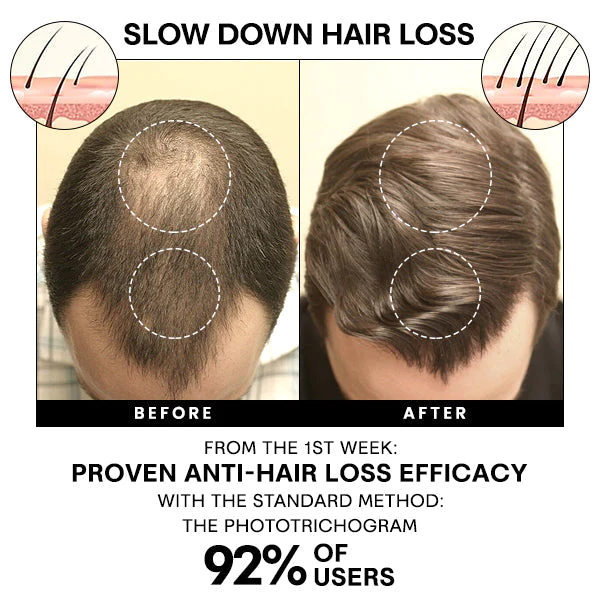 Blusoms Master Anti-Shedding Hair Spray - Image 3