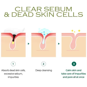 BodyAcne Removal TeaTree Cream