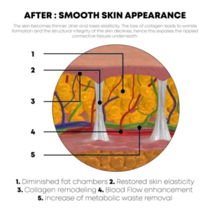 BodySlim Tightening Gel
