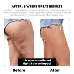 BodySlim Tightening Gel