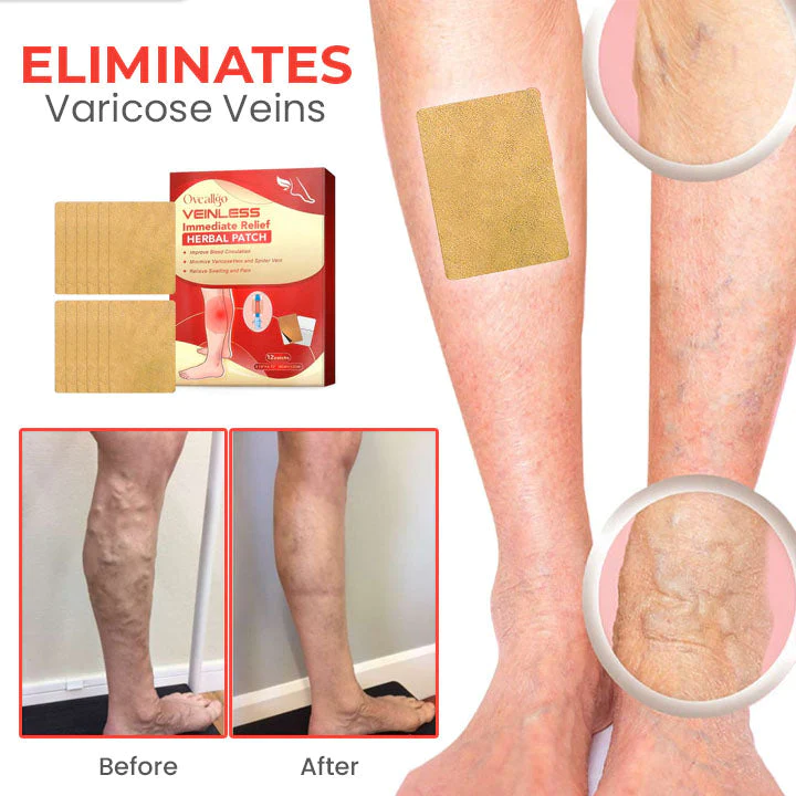 CC™ VeinLess Immediate Relief ravimtaimeplaaster