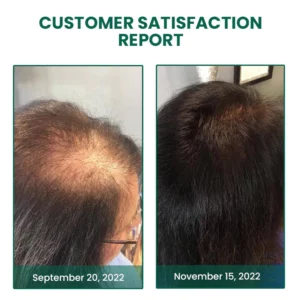 CC™ Glamor Ginger Essential Hair Growth Cream