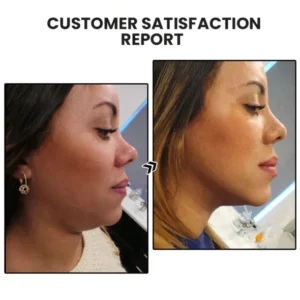 Alternative view of CC™ Lymphatic Drainage Slimming Earrings