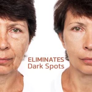 CC™ Pigmentless Treatment Facial Serum