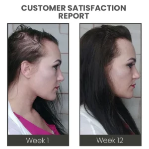 CC™ VENUSKISS Hair Stimulating Spray MAX