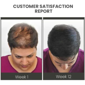 CC™ VENUSKISS Hair Stimulating Spray MAX