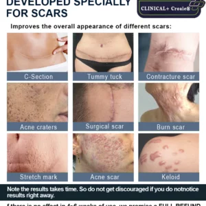 CLINICAL+ Croaie® Advanced Scar Repair Gel