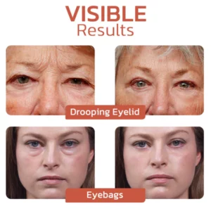 CaffeineEYES Repair and Lifting Eye Cream