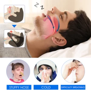 CalmAir™ Snoring Nasal Spray