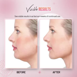 CareV™ EMSculpt Sleeping V-Face Beauty Device