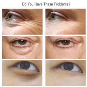 Caviar Eye Serum