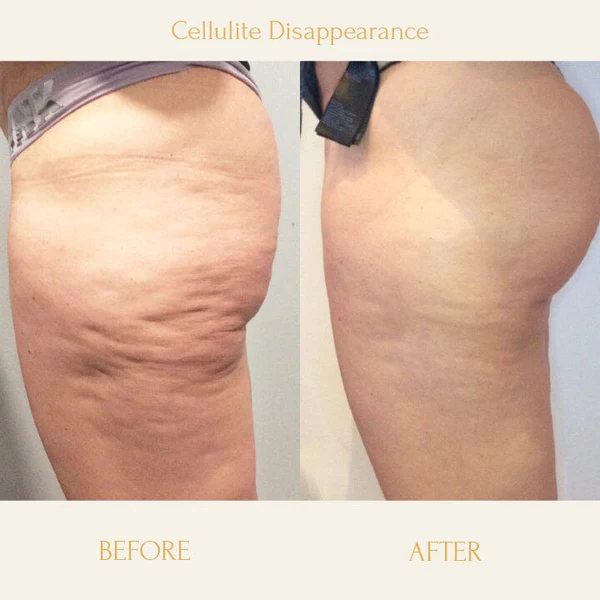 Ceoerty™ Anti-Cellulite Firming Sabulu