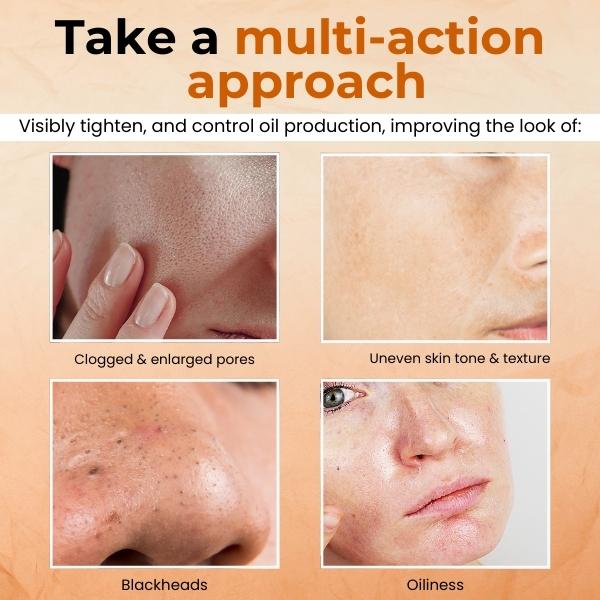 DermaZen™ Pore Minimizer Gesichtsmaske