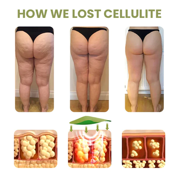 Dr. Slim™ Cellulite Reduktioun Patches