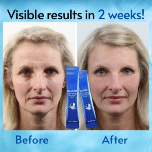 DreamSkin™ Anti-aging Sleeping Mask