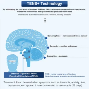 Alternative view of Dream™ TENS+ Headache Relief Sleep Massager