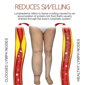 EELHOE™ AntiSwelling LympUnclog Ointment